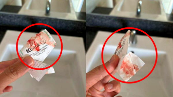 "갑자기 팔이 축축하고 끈적"…지하철에서 피 묻히고 사라진 정체불명 남성