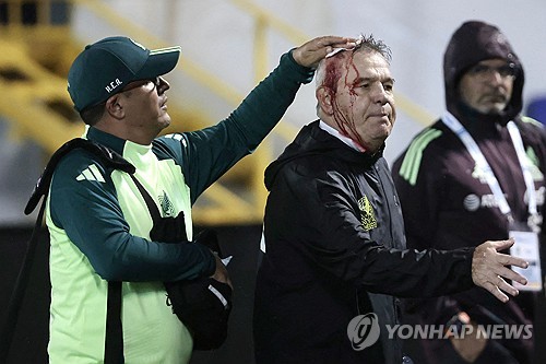 아기레 멕시코 축구대표팀 감독, 관중이 던진 캔에 맞아 출혈