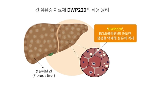 [게시판] 대웅제약 "간 섬유증 신약후보물질, 신약개발사업과제 선정"