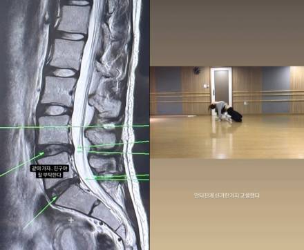 이채연, 허리디스크 건강 적신호 “춤 잠깐 쉴 것… 내년에 정상영업” [왓IS]