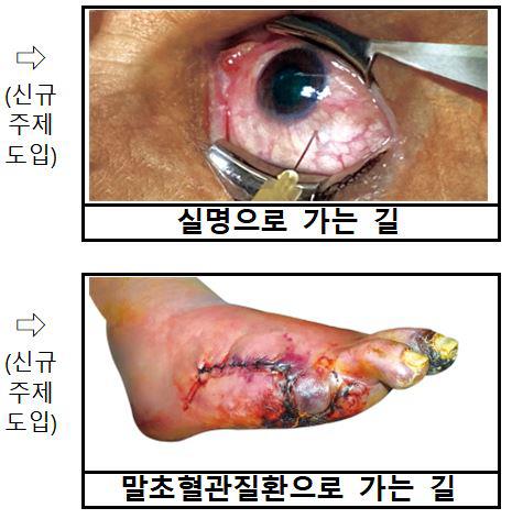 '폐암으로 가는 길' 담뱃갑 새 건강경고 문구·그림 적용