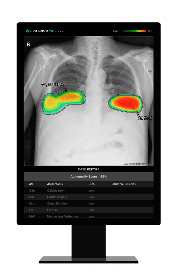 Lunit INSIGHT CXR. [사진=루닛] 