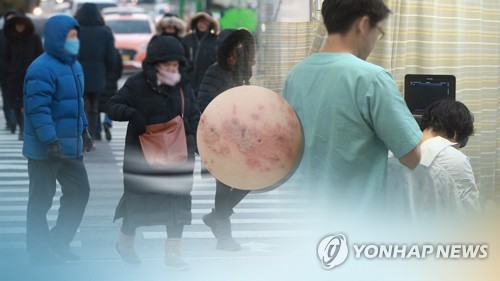 성남시, 65세 이상 모든 시민에 대상포진 무료접종 추진