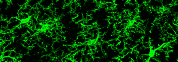 뇌의 미세아교세포를 형광 전자현미경으로 찍은 사진미국 로체스터대 제공