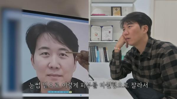 도경완 ‘성형 선언’에 ♥장윤정 반응…성형 견적 1200만원