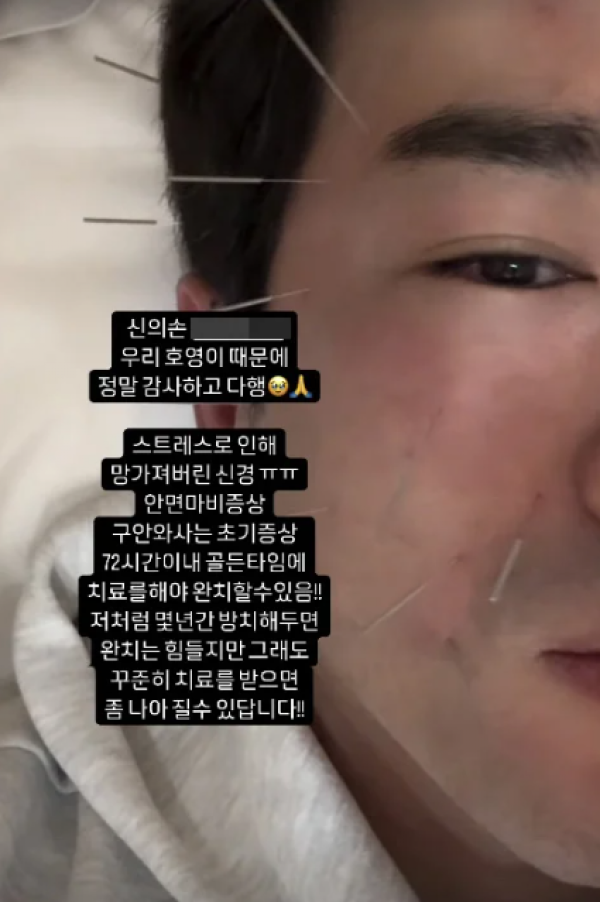 신화 이민우, 안면신경마비 고백… 몇 년간 방치해 완치는 어려워