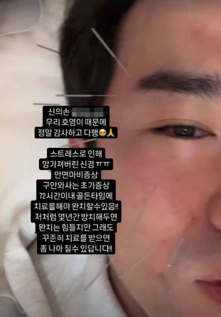 이민우, 안면마비 고통 호소 “스트레스 탓 신경 망가져”