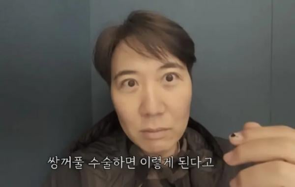 ‘장윤정♥’ 도경완, 쌍꺼풀 수술로 몰라보게 변한 얼굴 공개