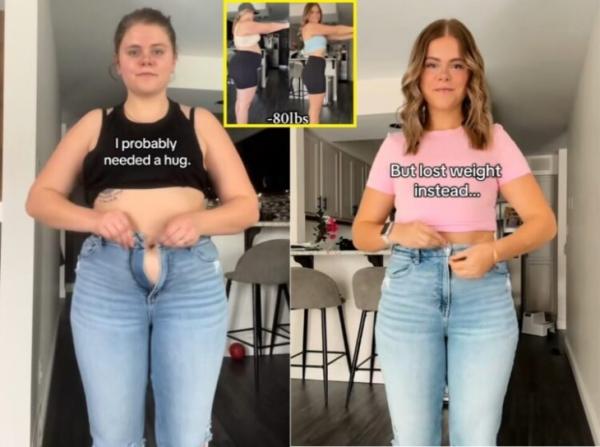“헬스장 안 가고 ‘이것’ 끊었다”…36㎏ 감량 女, 간단히 살 빼는 법 공개