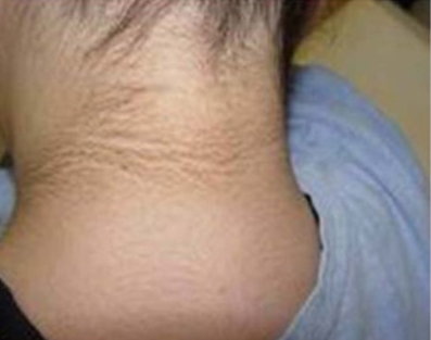 ‘때’ 낀 줄 알고 빡빡 밀어도 소용없다?…‘이 증상’ 의심해보라는데