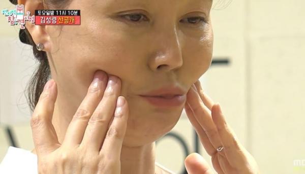김성령 “보톡스 맞으며 연기”…목소리 앗아간 ‘이 병’ 뭐길래