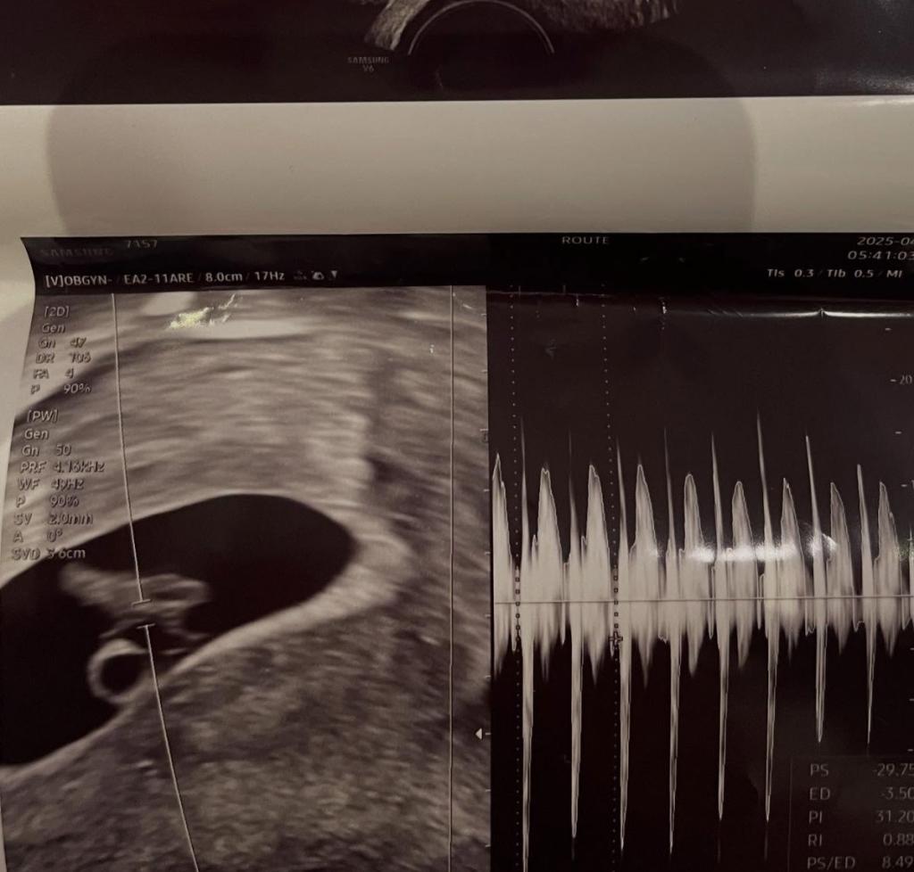 Seominjae baby ultrasound photo / Source: Instagram Seominjae baby ultrasound photo / Source: Instagram