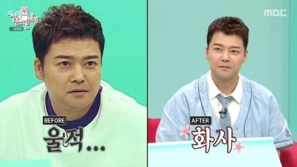전현무 맞아? “만족도 높아” 수술 후 몰라보게 젊어진 모습