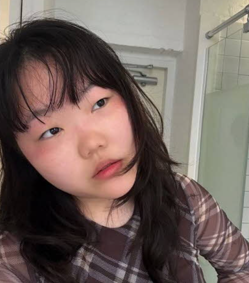 얼룩덜룩해진 피부 ‘깜짝’…악뮤 이수현이 경고한 ‘이 행동’ 뭐길래