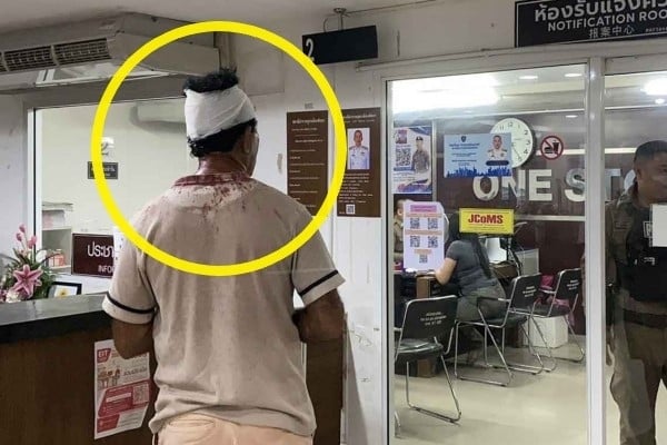 “여자 맞나 확인 좀” 신체부위 2번 더듬은 관광객… 파타야서 피 철철 흘린 사연