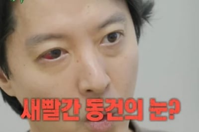“송곳으로 찌르는 느낌” 이동건 새빨간 눈…1% 희귀병 진단