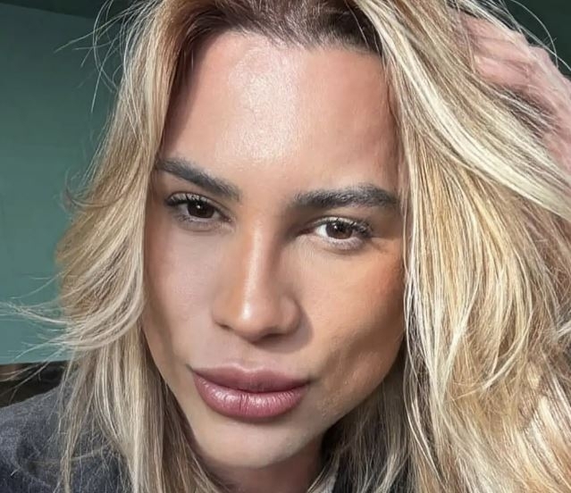 성형 수술 후 숨진 인플루언서 아다이르 멘데스 두트라 주니어(31). 소셜미디어(SNS) 캡처