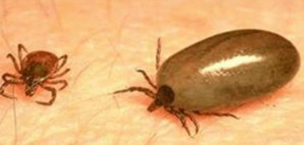 치료제 없는데 올해만 220명…韓서 급증한 ‘살인 진드기병’ 정체